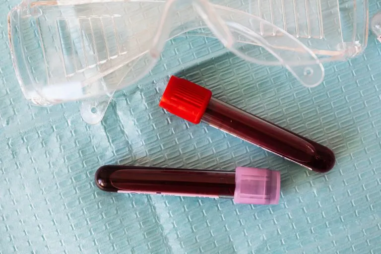Perché esce il sangue dal naso