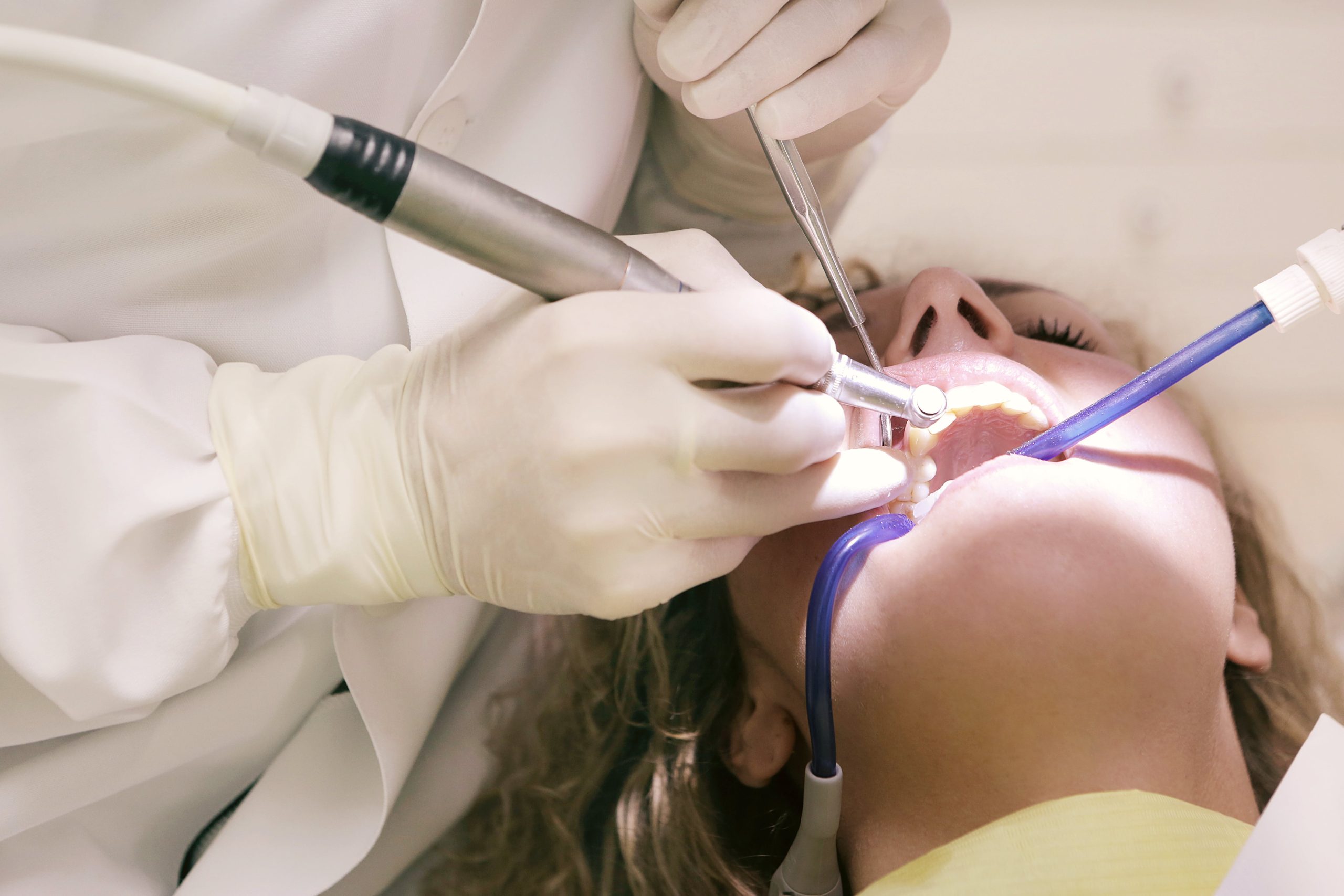 La popolarità dei dentisti e delle faccette dentali